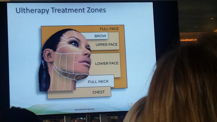 Ultherapy Treatment Zones